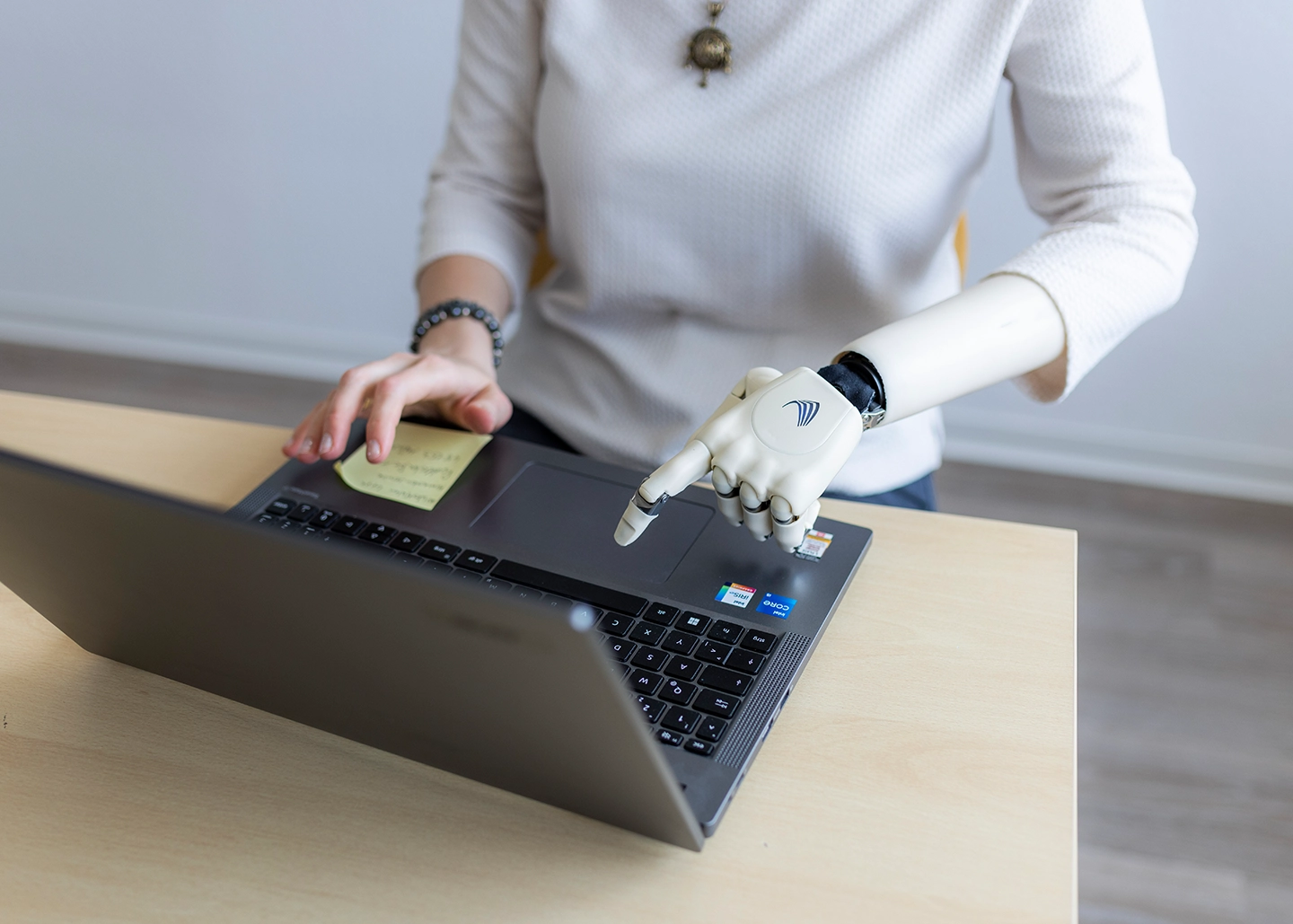 Frau mit Armprothese tippt mit Prothesenhand auf Laptop Tastatur