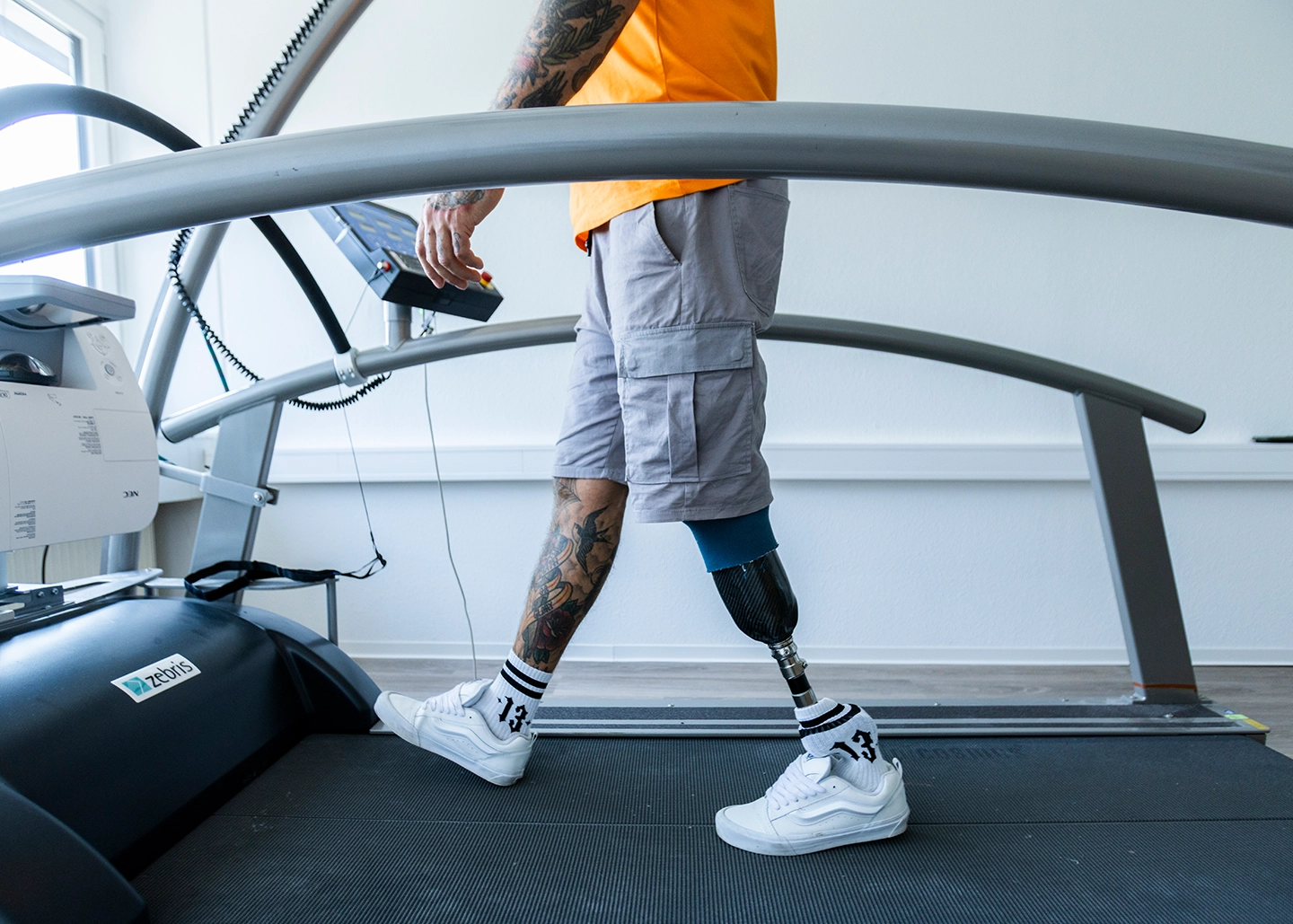 Man geht mit einer Beinprothese auf einem Laufband bei APT Prothesen