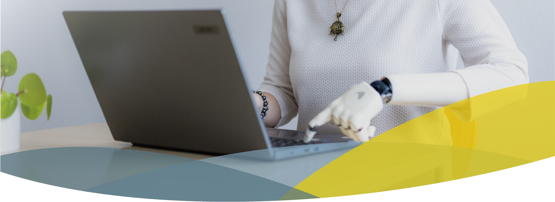 Headerbild für APT Service Zentrale, Frau tippt mit Prothesenhand auf einem Laptop