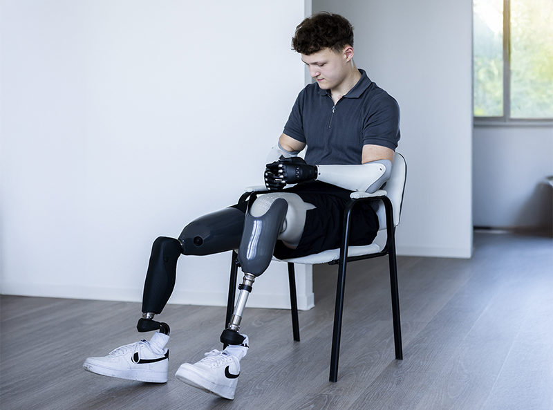 Kunde mit zwei Beinprothesen und zwei Armprothesen sitzt auf einem Stuhl und schaut nach unten
