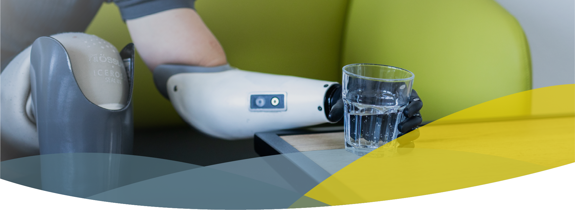 Headerbild für Niederlassungen, Person mit Beinprothese und Armprothese stellt ein Glas Wasser auf den Tisch